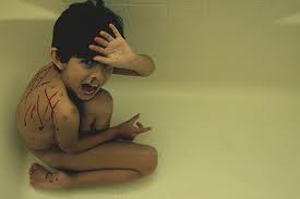 Child Physical Abuse Laceration Marks