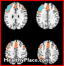 Some people find ECT distressing to receive, but the adverse psychological effects of ECT are little understood. Read this abstract to understand more.