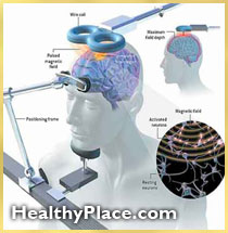 Repetitive transcranial magnetic stimulation (rTMS) can be used to treat depression. Learn about TMS therapy and magnetic stimulation of the brain.