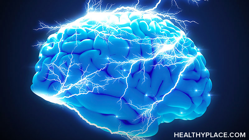 brain scan schizophrenia