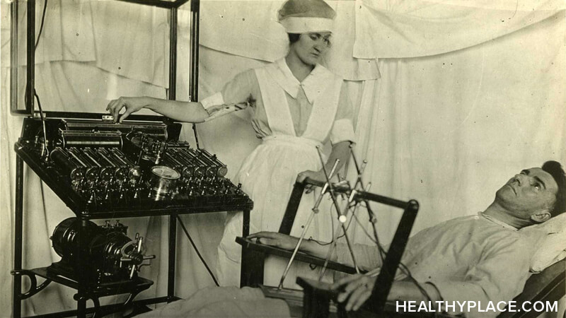 History of ECT, beginning with the induction of seizures to treat mental illness up to vastly improved, modern ECT procedures in use today.