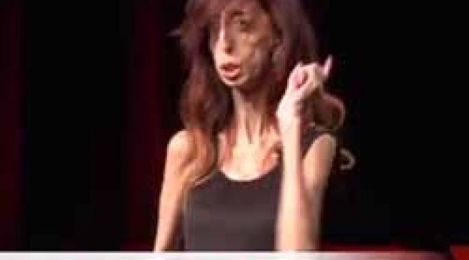 If you self-harm and are looking for a role model, let me introduce you to Lizzie Velasquez. Lizzie has used her lifelong struggles to help her move forward.