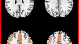 Some people find ECT distressing to receive, but the adverse psychological effects of ECT are little understood. Read this abstract to understand more.