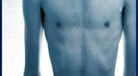 Boys and men get anorexia nervosa and bulimia nervosa. Find here what eating disorders do they get, what are the risk factors, and the treatment of males with eating disorders such as anorexia, bulimia, and binge eating.