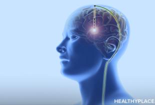 Deep brain stimulation is a form of surgical treatment. It can be effective for treating brain disorders, but what are the risks? Find out on HealthyPlace.