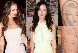 foxtattooremovalpng