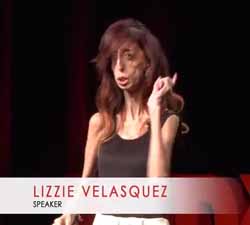 If you self-harm and are looking for a role model, let me introduce you to Lizzie Velasquez. Lizzie has used her lifelong struggles to help her move forward.