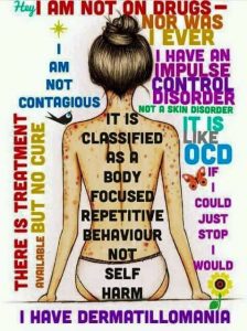 Don't call excoriation a habit. Find out why the word habit does not describe excoriation disorder or the other body-focused repetitive behaviors of OCD, 