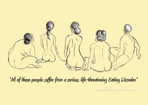 The binge eating disorder body type probably isn't what you think it is. In fact, there is no eating disorder body type - every body is different. Read this.