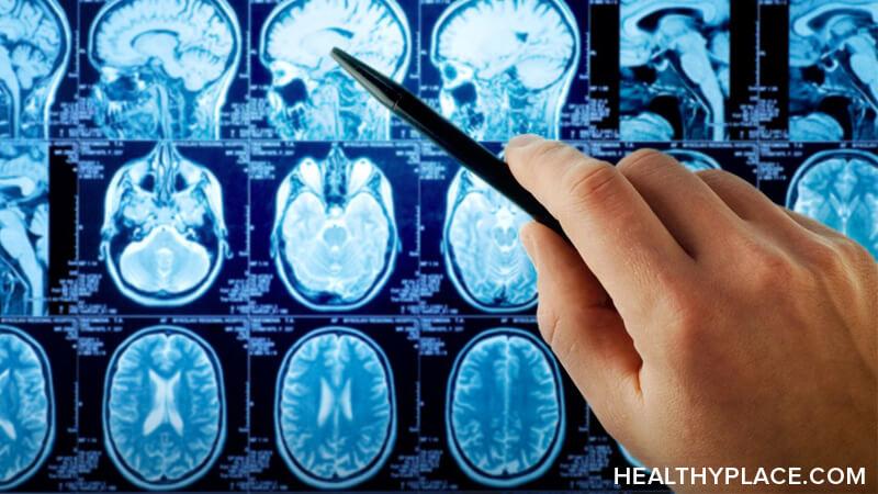 Head Injuries can cause anxiety. Those of us with TBI suspected as much, but now it's been proven. Learn the latest research about head injury and anxiety at HealthyPlace. Concussions do cause anxiety, and here's why.