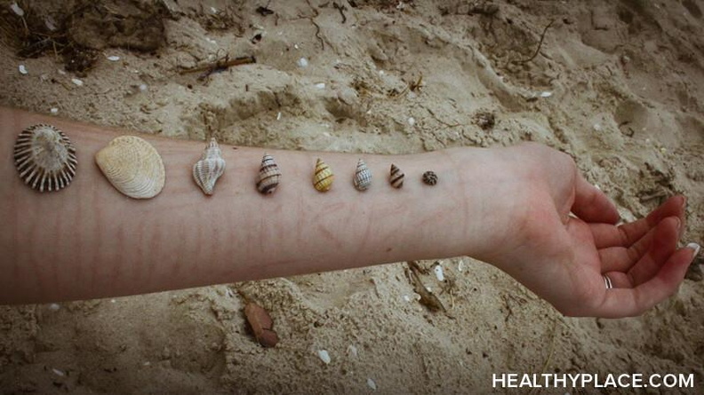 Self-Injury Information, Resources & Support Detailed information about Self-Injury (Self-Harm, Self-Abuse, Self-Mutilation) including why people self-injure, warning signs of self-harm, treatment for self-injury and information for parents.